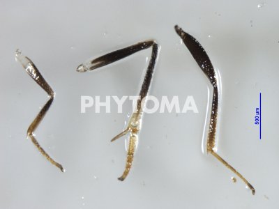 Estructura de las patas: detalle de la pata anterior,media y trasera.